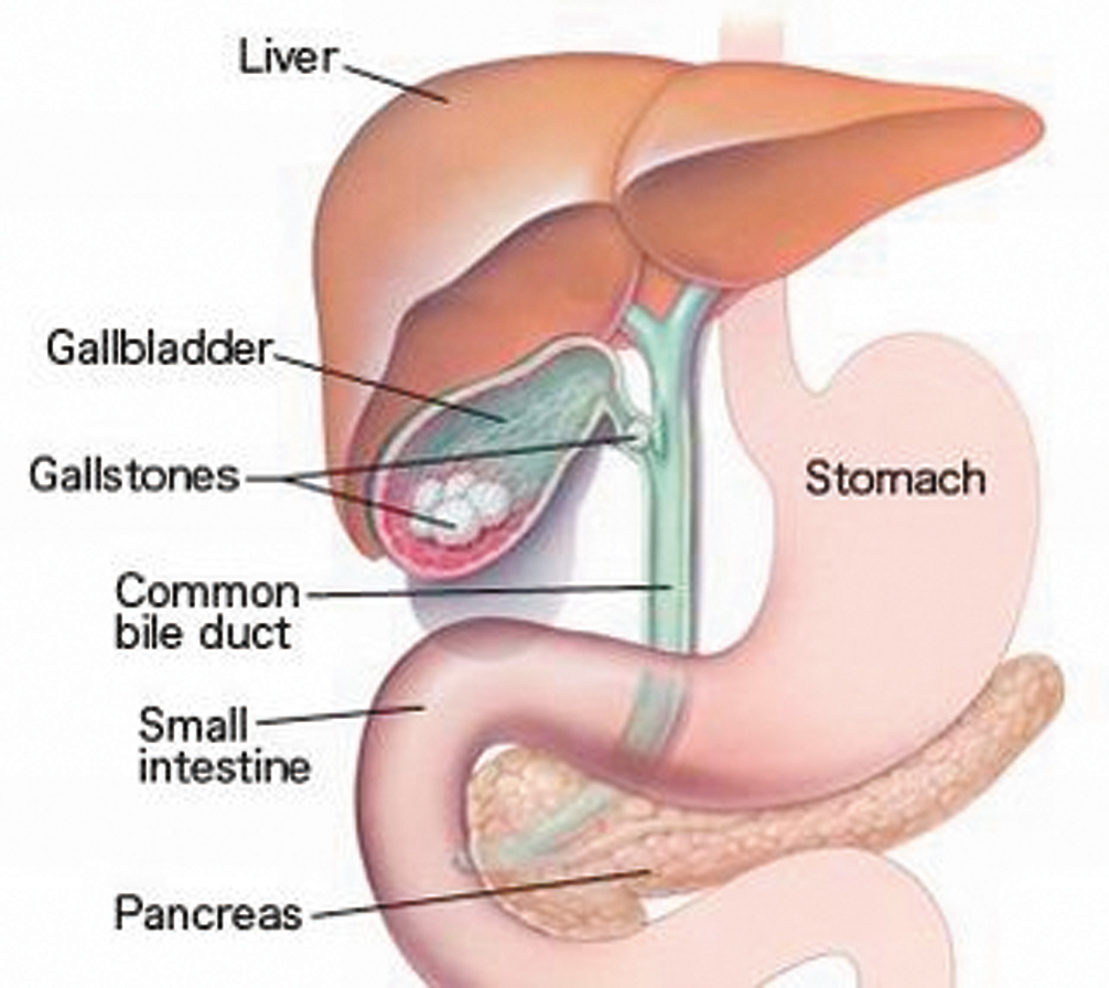 Lumpectomy Testimonials